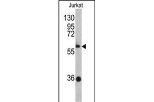 Western blot analysis of ZBTB2 antibody (C-term) (ABIN390710 and ABIN2840992) in Jurkat cell line lysates (35 μg/lane). (ZBTB2 antibody  (C-Term))