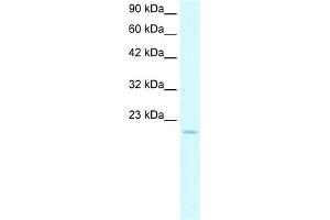 WB Suggested Anti-ARNTL Antibody Titration:  5.