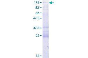 CC2D1A Protein (AA 1-951) (GST tag)