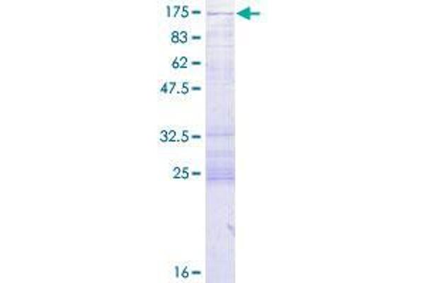CC2D1A Protein (AA 1-951) (GST tag)