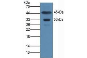 Detection of APOA1BP in Rat Muscle Tissue using Polyclonal Antibody to Apolipoprotein A1 Binding Protein (APOA1BP)
