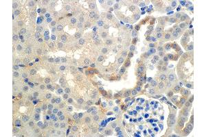 Immunohistochemistry analysis using Mouse Anti-ENaC beta Monoclonal Antibody, Clone 7B8 . (SCNN1B antibody  (AA 617-638))