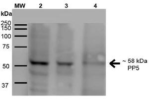 Western Blot analysis of Human A431, HEK293, and Jurkat cell lysates showing detection of ~58 kDa PP5 protein using Mouse Anti-PP5 Monoclonal Antibody, Clone 2E11 .