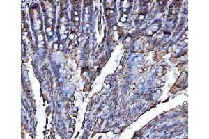 IHC analysis of VAPA using anti-VAPA antibody (ABIN7603249). (VAPA antibody  (N-Term))