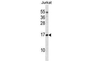 TCEB1 Antibody (C-term) western blot analysis in Jurkat cell line lysates (35 µg/lane). (TCEB1 antibody  (C-Term))
