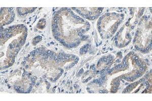 ABIN6274207 at 1/100 staining Human prostate tissue by IHC-P. (DTYMK antibody  (Internal Region))