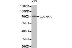 Western Blotting (WB) image for anti-Chloride Channel Ka (CLCNKA) antibody (ABIN1871886)