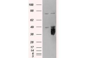 Image no. 2 for anti-Tissue Factor Pathway Inhibitor (Lipoprotein-Associated Coagulation Inhibitor) (TFPI) (C-Term) antibody (ABIN374077) (TFPI antibody  (C-Term))