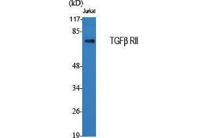 Western Blotting (WB) image for anti-Transforming Growth Factor, beta Receptor II (70/80kDa) (TGFBR2) (Internal Region) antibody (ABIN3187248) (TGFBR2 antibody  (Internal Region))