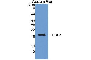 Figure. (Leptin Receptor antibody  (AA 238-375))