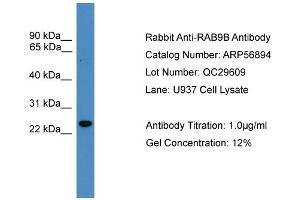 WB Suggested Anti-RAB9B  Antibody Titration: 0. (RAB9B antibody  (N-Term))