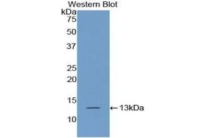 Detection of Recombinant PABPC1L, Human using Polyclonal Antibody to Poly A Binding Protein Cytoplasmic 1 Like Protein (PABPC1L) (PABPC1L antibody  (AA 514-612))