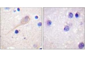 Immunohistochemistry (IHC) image for anti-Parkinson Protein 2, E3 Ubiquitin Protein Ligase (Parkin) (PARK2) (AA 101-150) antibody (ABIN2888688) (Parkin antibody  (AA 101-150))