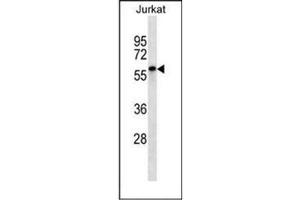 Western blot analysis of ENOX2 Antibody (N-term) in Jurkat cell line lysates (35ug/lane).