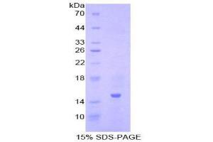 SDS-PAGE (SDS) image for Inhibin, beta A (INHBA) (AA 309-424) protein (His tag) (ABIN2121293) (INHBA Protein (AA 309-424) (His tag))