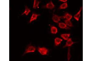 ABIN6269176 staining Hela by IF/ICC. (PTPN1 antibody  (N-Term))