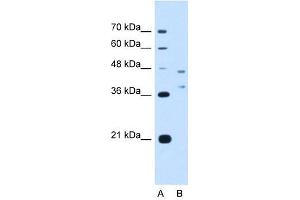EVI2B antibody used at 2. (EVI2B antibody  (Middle Region))