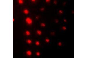 Immunofluorescent analysis of ZNF7 staining in HeLa cells. (ZNF7 antibody  (N-Term))