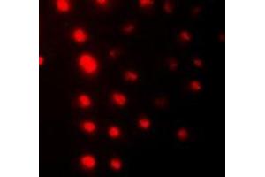 Immunofluorescent analysis of ZNF7 staining in HeLa cells.