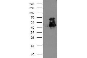 HEK293T cells were transfected with the pCMV6-ENTRY control (Left lane) or pCMV6-ENTRY ELK3 (Right lane) cDNA for 48 hrs and lysed. (ELK3 antibody)