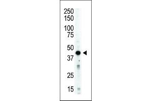 Antibody is used in Western blot to detect STK12 in mouse spleen tissue lysate.