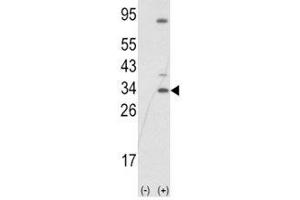 Western blot analysis of SNAI1 antibody and 293 cell lysate (2 ug/lane) either nontransfected (Lane 1) or transiently transfected with the SNAIL gene (2). (SNAIL antibody  (AA 1-30))