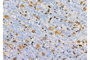 ABIN6257466 and ABIN6274772 at 1/100 staining Rat brain tissue by IHC-P. (RPL19 antibody  (C-Term))