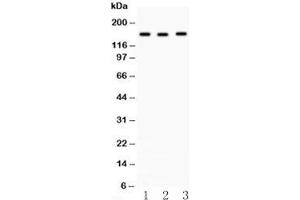 Western blot testing of ACE antibody and (1) HeLa, (2) A549 and (3) 22RV1 lysate. (Angiotensin I Converting Enzyme 1 antibody  (Middle Region))