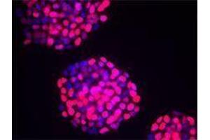 Immunofluorescence (IF) image for anti-Tumor Protein P53 (TP53) antibody (ABIN2664006) (p53 antibody)
