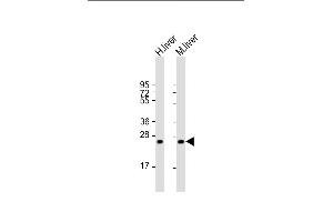 Western Blotting (WB) image for anti-Hyaluronan Binding Protein 2 (HABP2) (AA 378-408), (C-Term) antibody (ABIN651853)