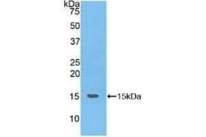 Detection of Recombinant NKB, Human using Polyclonal Antibody to Neurokinin B (NKB) (Tachykinin 3 antibody  (AA 23-121))