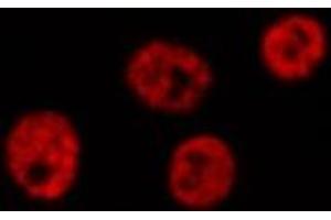 ABIN6276851 staining HepG2? (LIG4 antibody  (C-Term))
