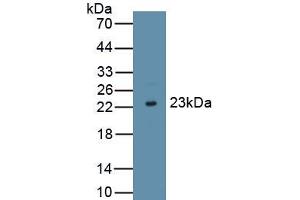 Detection of Recombinant IFNt, Bovine using Polyclonal Antibody to Interferon Tau (IFNt) (Interferon Tau antibody  (AA 24-195))