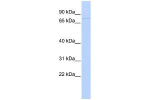 KIF9 antibody used at 1 ug/ml to detect target protein. (KIF9 antibody  (N-Term))