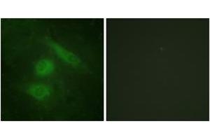 Immunofluorescence analysis of HeLa cells, using IRF3 (Ab-385) Antibody. (IRF3 antibody  (AA 351-400))
