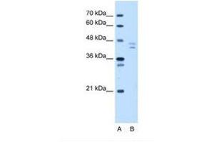 Image no. 1 for anti-Proteasome (Prosome, Macropain) 26S Subunit, Non-ATPase, 11 (PSMD11) (N-Term) antibody (ABIN324265) (PSMD11 antibody  (N-Term))