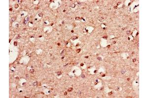 Immunohistochemistry of paraffin-embedded human brain tissue using ABIN7157902 at dilution of 1:100 (LANCL1 antibody  (AA 50-150))