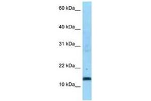 Image no. 1 for anti-Succinate Dehydrogenase Complex, Subunit C, Integral Membrane Protein, 15kDa (SDHC) (AA 59-108) antibody (ABIN6748189) (SDHC antibody  (AA 59-108))