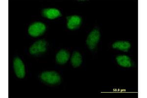 Immunofluorescence of purified MaxPab antibody to ZNF503 on HeLa cell. (ZNF503 antibody  (AA 1-646))