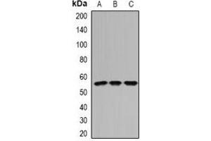 Western blot analysis of IFI44 expression in Hela (A), mouse kidney (B), rat kidney (C) whole cell lysates. (IFI44 antibody)