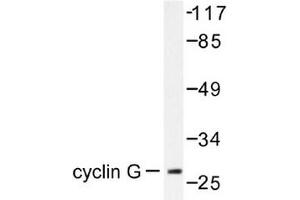 Image no. 1 for anti-Cyclin G1 (CCNG1) antibody (ABIN265382) (Cyclin G1 antibody)