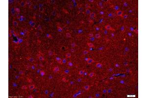 Formalin-fixed and paraffin embedded rat brain tissue probed with Anti-IDUA Polyclonal Antibody (ABIN1713845) at a dilution of 1:200 overnight at 4°C, followed by Goat Anti-Rabbit secondary, Cy3 conjugated at 1:200 dilution for 40 minutes at (IDUA antibody  (AA 101-200))