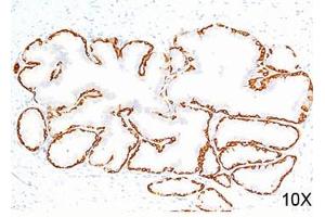 IHC testing of human prostate (10X) stained with Cytokeratin 14 antibody (LL002).