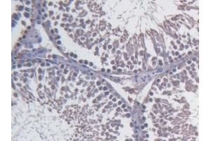 Detection of FBLN1 in Rat Testis Tissue using Monoclonal Antibody to Fibulin 1 (FBLN1) (Fibulin 1 antibody)