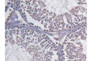 Detection of FBLN1 in Rat Testis Tissue using Monoclonal Antibody to Fibulin 1 (FBLN1)