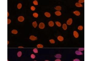 Immunofluorescence analysis of C6 cells using TADA3 Polyclonal Antibody at dilution of 1:100.