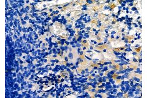 anti-Tumor Necrosis Factor (Ligand) Superfamily, Member 14 (TNFSF14) (Internal Region) antibody