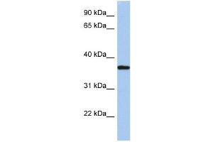 LDLRAP1 antibody used at 1 ug/ml to detect target protein. (LDLRAP1 antibody  (N-Term))