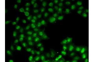 Immunofluorescence analysis of U2OS cells using C11orf30 antibody (ABIN6127846, ABIN6137723, ABIN6137725 and ABIN6221740). (EMSY antibody  (AA 1153-1322))