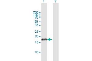 Western Blot analysis of VHLL expression in transfected 293T cell line by VHLL MaxPab polyclonal antibody. (VHLL antibody  (AA 1-139))